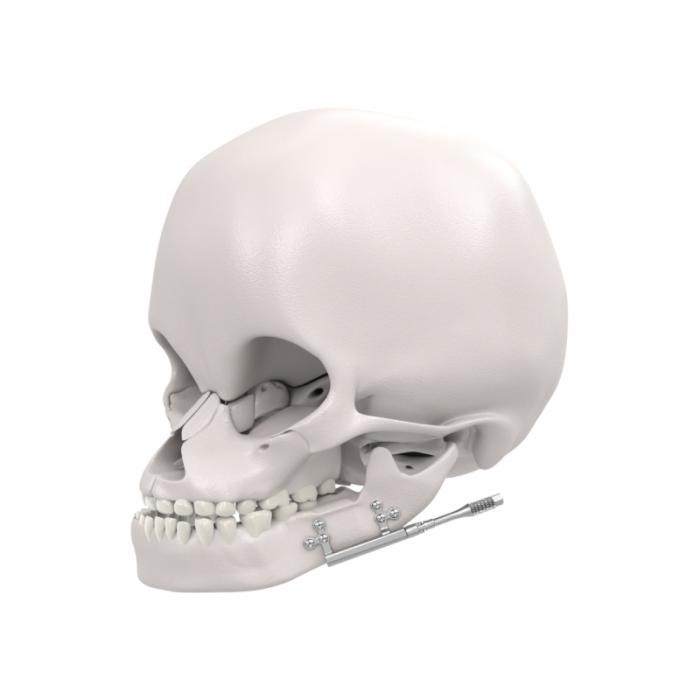 Maxiliofacial System